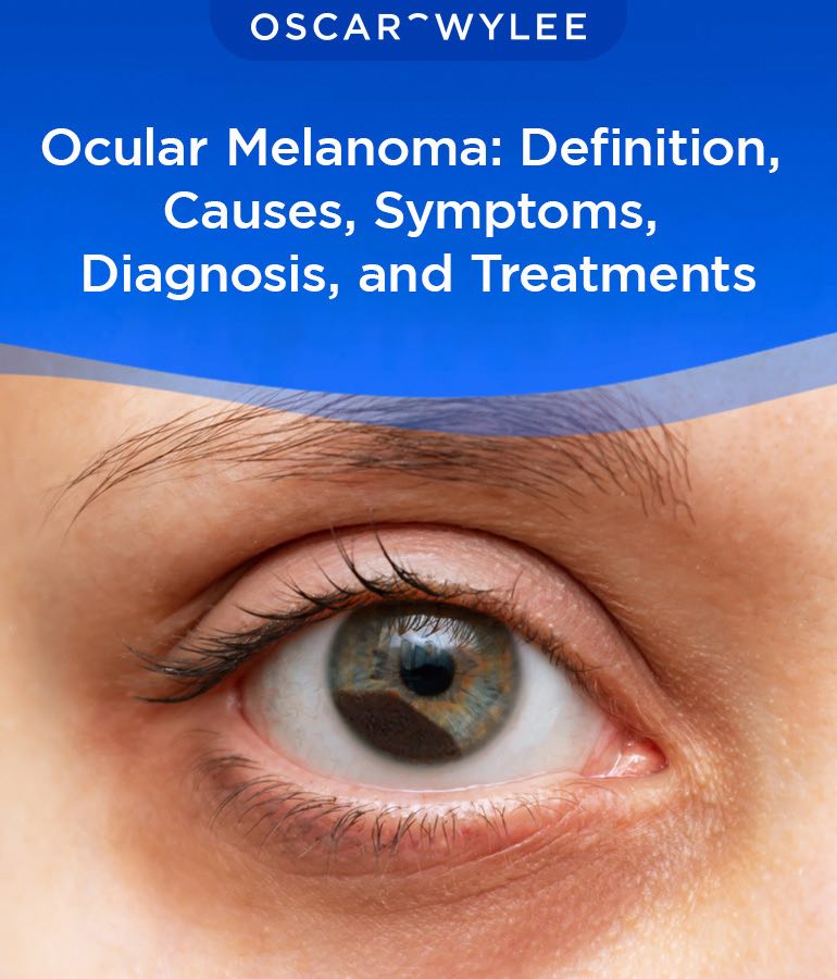 Ocular Eye (Melanoma) Causes and Treatment.