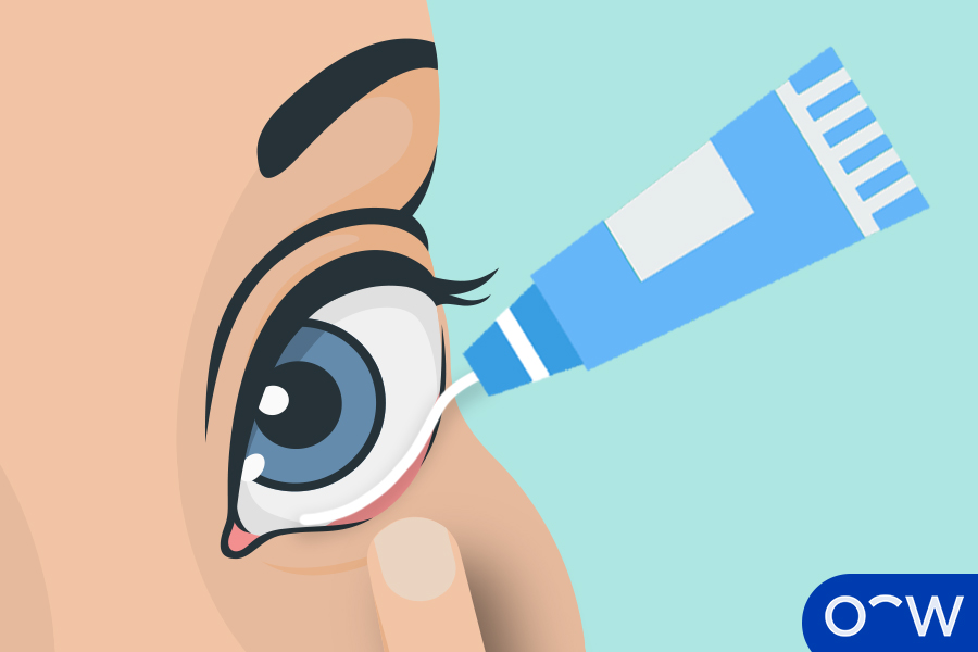 Put a small bit of eye ointment into your eye