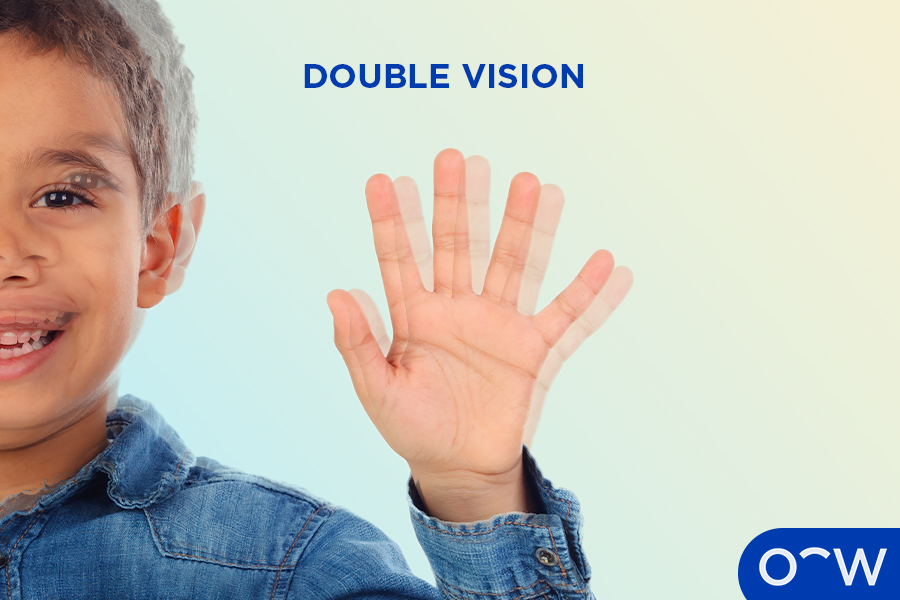 A child experiencing the eye problem of double vision.