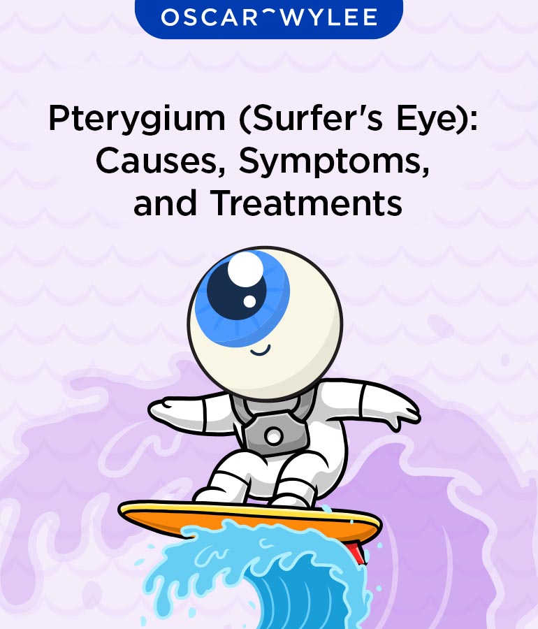 Pterygium (Surfer's Eye): Causes, Symptoms, and Treatment