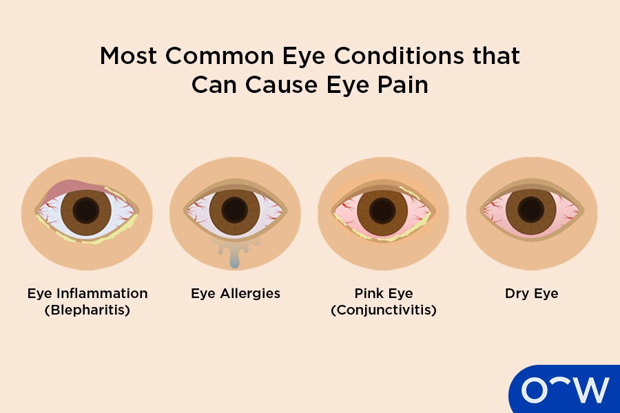 Common eye conditions that can cause eye pain when waking up.