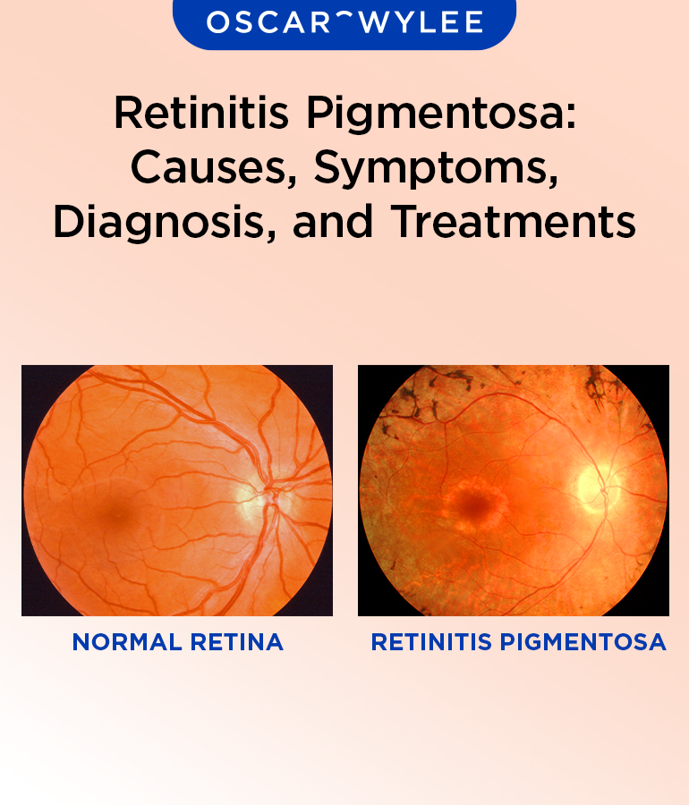 Retinitis Pigmentosa.