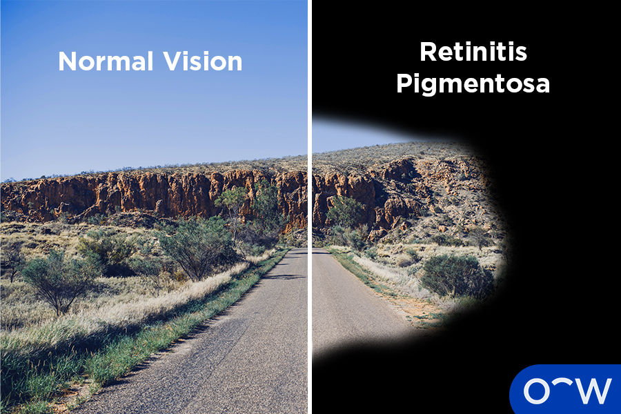 The first side of the image shows a normal view of the road, and the second side shows the view of the road with tunnel vision.