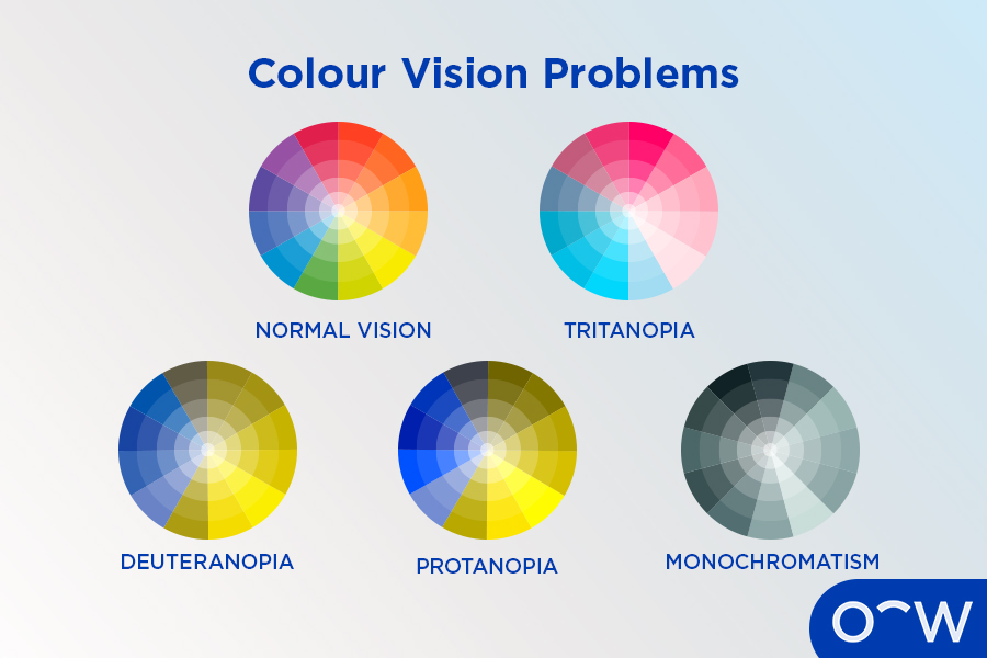 The different types of colour blindness as a result of retinitis pigmentosa