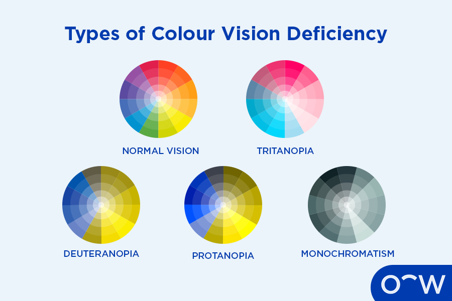 A diagram of the different types of colour vision deficiency.