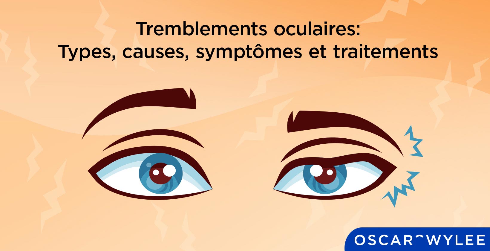 Tremblements oculaires : Types, causes, symptômes et traitements