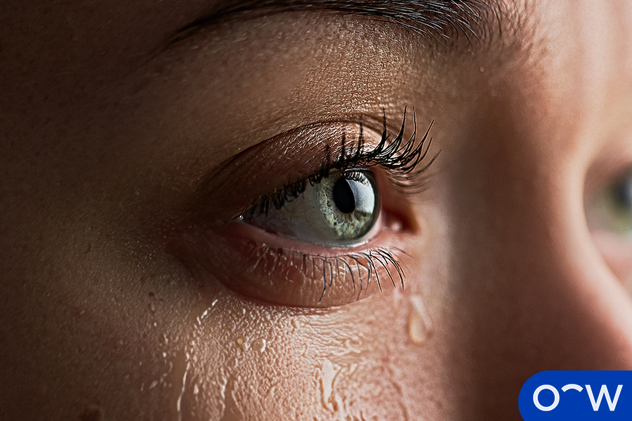 Close up of an eye with excessive tearing as a possible symptom of eye problems