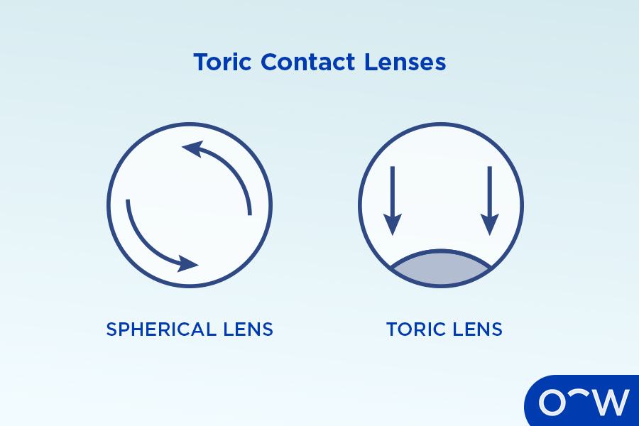 The graphic displays a spherical lens on one side and a toric lens on the other side.