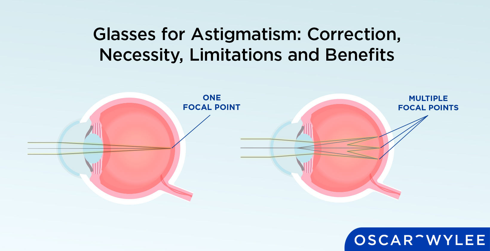 Glasses for Astigmatism